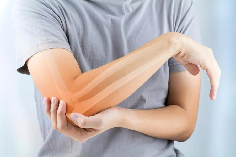 Osteoporosis-Doctor A close-up of a woman holding her elbow with an illustration of the bones and joint experiencing pain from osteoporosis. Get osteoporosis treatment from Thrive Family Practice & Med Spa in Statesboro.