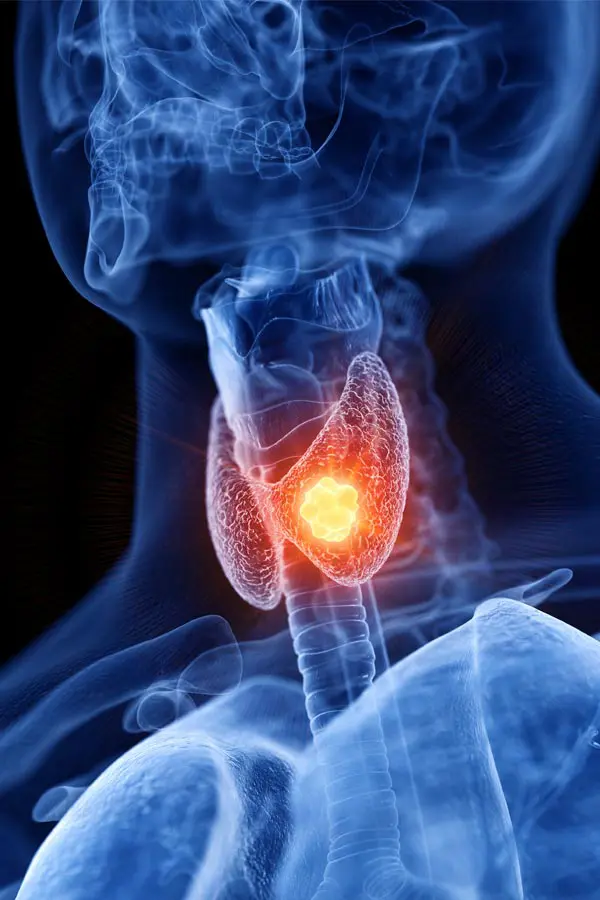 Thyroid-Imbalance-Treatment A 3D illustration of an x-ray of a human neck, highlighting the thyroid. Get help with thyroid imbalance from Thrive Family Practice & Med Spa in Statesboro.